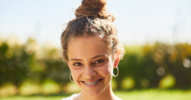 image-6 6 Easy Ways to Care For Your Braces