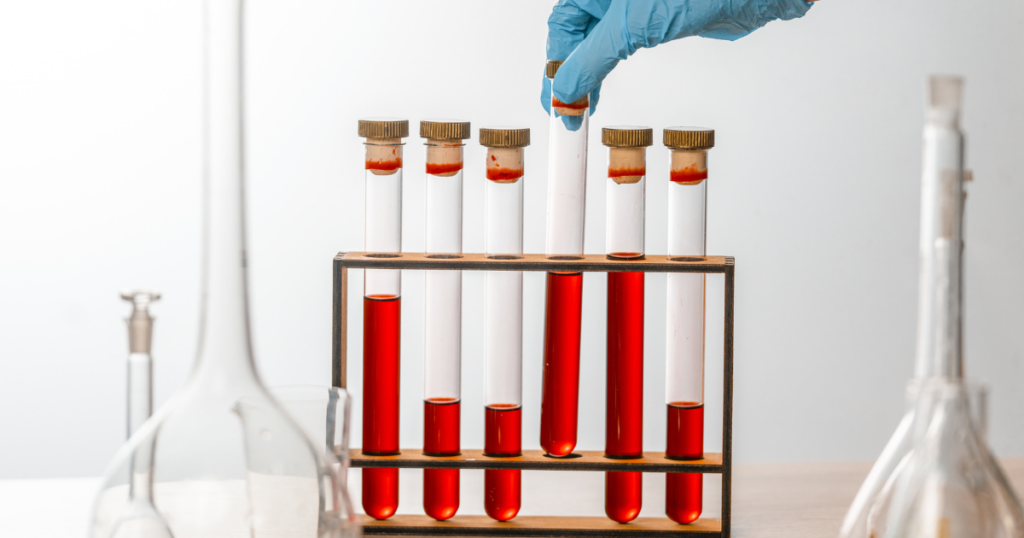 Guest-Post-2026-04-25T140438.321-1024x538 What Lab Test for Mold Exposure You Can Trust