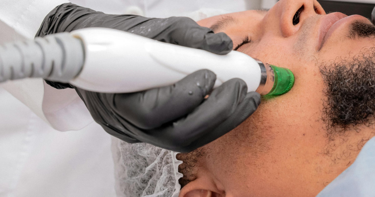 can you start and stop laser hair removal