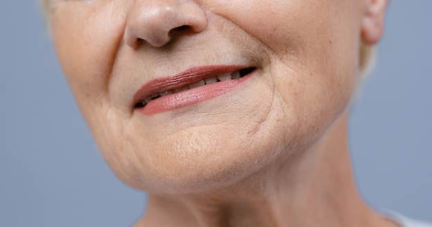 image-11 How Long Does Anti Wrinkle Injections Take to Work?
