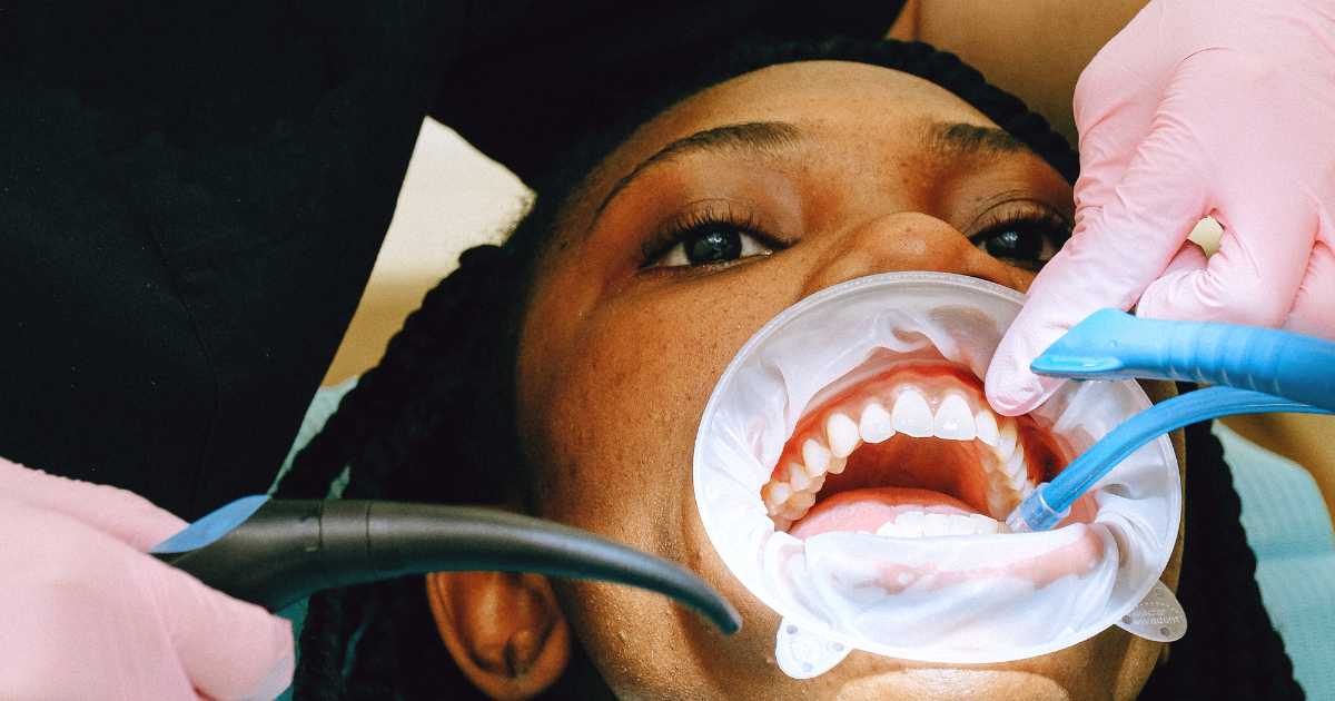 are teeth whitening strips good for your teeth